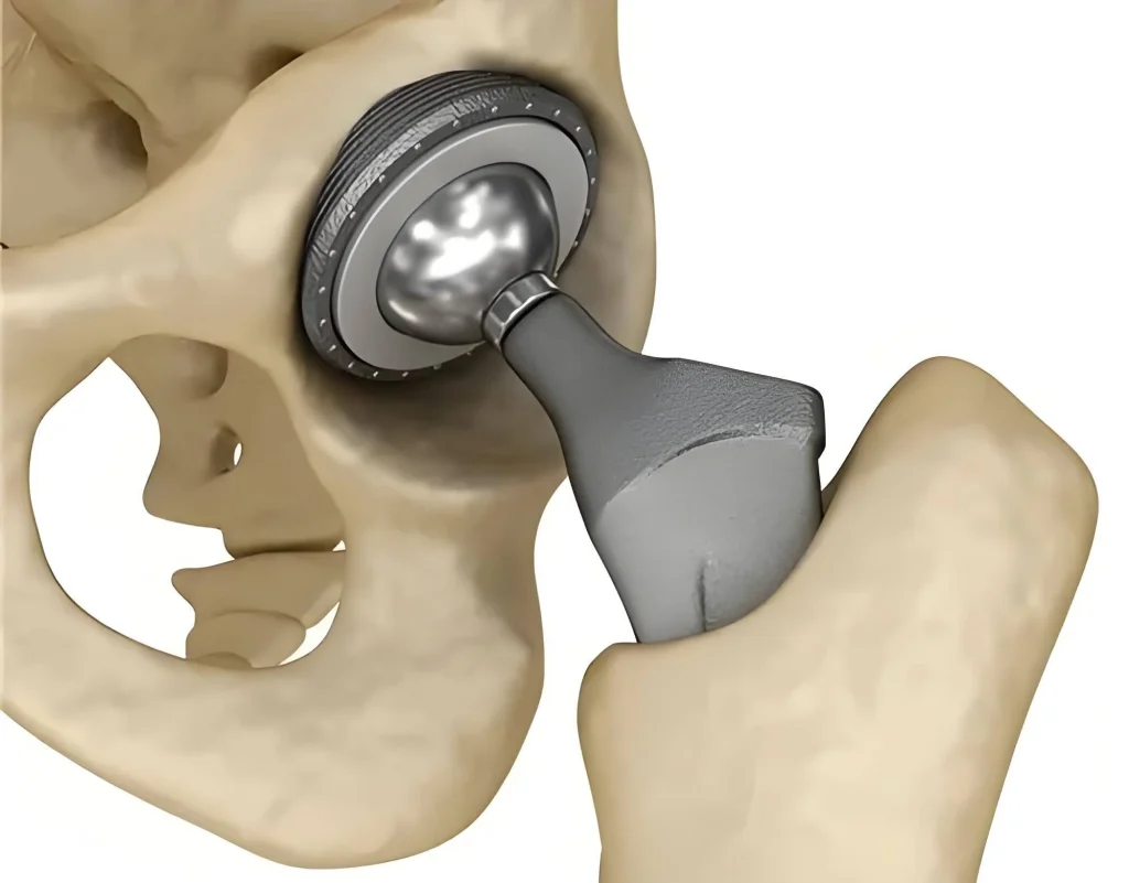 749c4e8092e875d2e9e9008e94d70a66